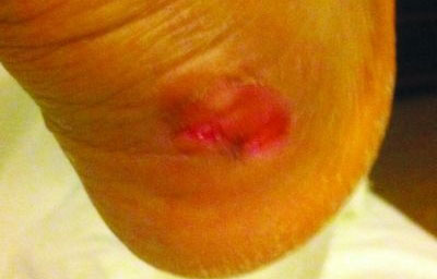 CBA球員抱怨李寧球鞋質(zhì)量太差 后腳跟險被磨爛